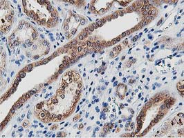 m08421 anti lcmt1 mouse monoclonal antibody clone id oti4a5 ihc testing 10