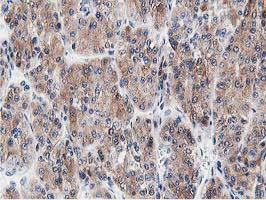 m08421 anti lcmt1 mouse monoclonal antibody clone id oti4a5 ihc testing 11