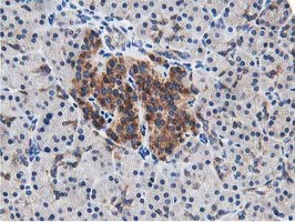 m08421 anti lcmt1 mouse monoclonal antibody clone id oti4a5 ihc testing 3