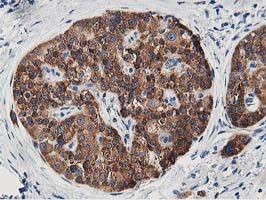 m08421 anti lcmt1 mouse monoclonal antibody clone id oti4a5 ihc testing 4