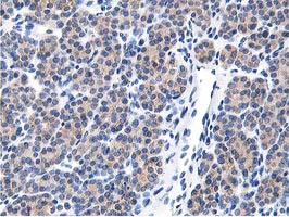 m08421 anti lcmt1 mouse monoclonal antibody clone id oti4a5 ihc testing 5