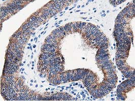 m08421 anti lcmt1 mouse monoclonal antibody clone id oti4a5 ihc testing 6