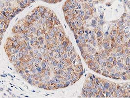 m08421 anti lcmt1 mouse monoclonal antibody clone id oti4a5 ihc testing 8