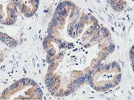 m08421 anti lcmt1 mouse monoclonal antibody clone id oti4a5 ihc testing 9