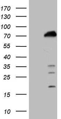 HEK293T cells were transfected with the pCMV6-ENTRY control (Left lane) or pCMV6-ENTRY POLA2 (Right lane) cDNA for 48 hrs and lysed