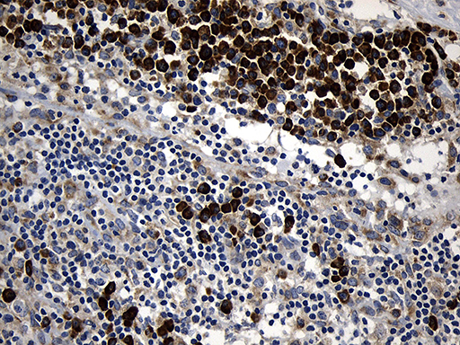 m08439 anti ccdc22 mouse monoclonal antibody clone id oti2e4 ihc testing 4