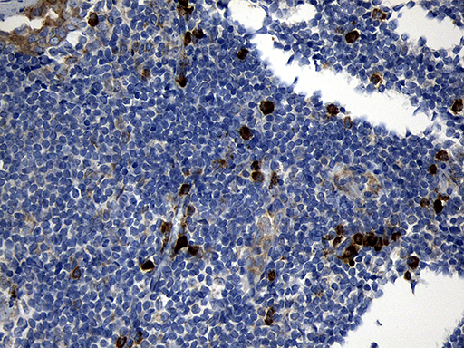 m08439 anti ccdc22 mouse monoclonal antibody clone id oti2e4 ihc testing 5