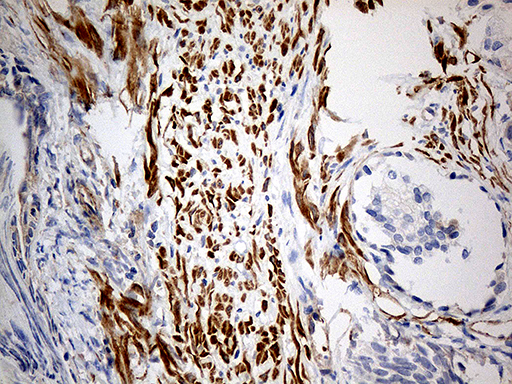m08452 anti kif6 mouse monoclonal antibody clone id oti5g2 ihc testing 2