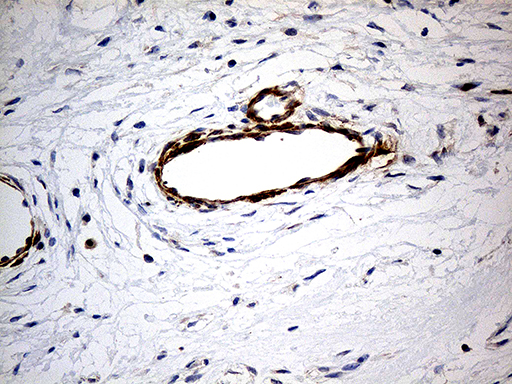 m08452 anti kif6 mouse monoclonal antibody clone id oti5g2 ihc testing 3
