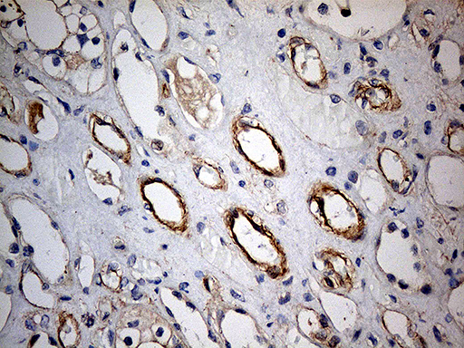 m08452 anti kif6 mouse monoclonal antibody clone id oti5g2 ihc testing 4
