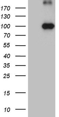 m08452 anti kif6 mouse monoclonal antibody clone id oti5g2 wb testing 1