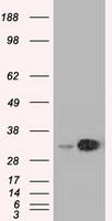 HEK293T cells were transfected with the pCMV6-ENTRY control (Left lane) or pCMV6-ENTRY EMG1 (Right lane) cDNA for 48 hrs and lysed