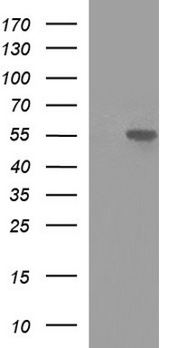 HEK293T cells were transfected with the pCMV6-ENTRY control (Left lane) or pCMV6-ENTRY MINPP1 (Right lane) cDNA for 48 hrs and lysed