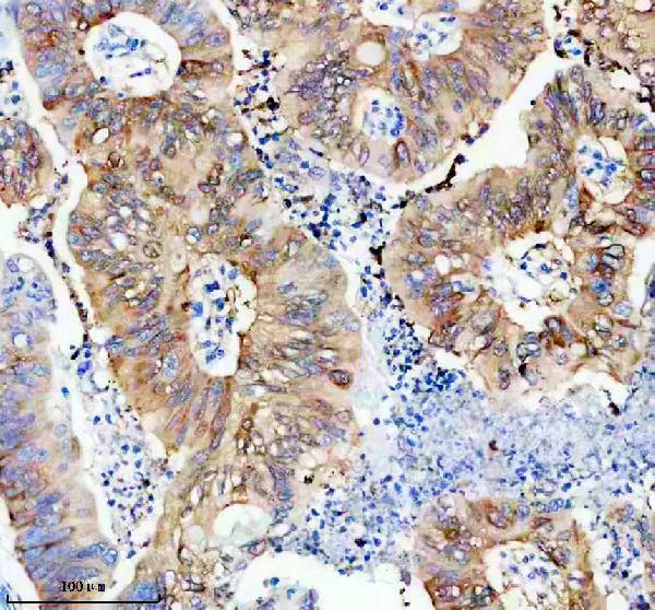 m08468 lgals4 primary antibodies ihc testing 1