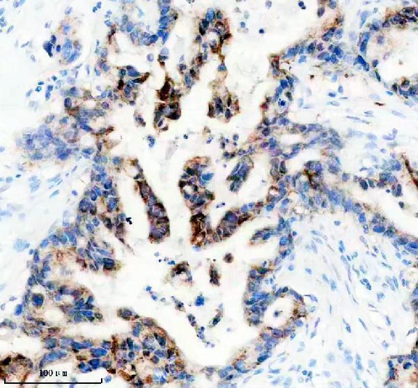 m08468 lgals4 primary antibodies ihc testing 2