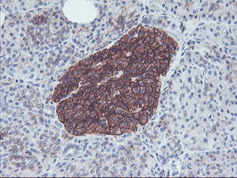 Immunohistochemical staining of paraffin-embedded Human pancreas tissue within the normal limits using anti-NPTN mouse monoclonal antibody