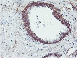 m08495 anti nptn mouse monoclonal antibody clone id oti3c4 ihc testing 6