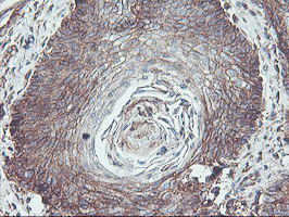 m08495 anti nptn mouse monoclonal antibody clone id oti3c4 ihc testing 7