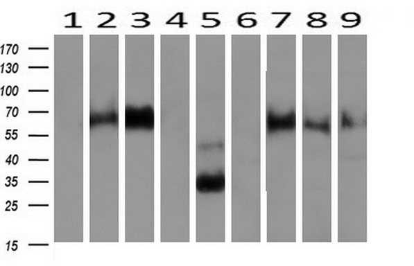 Western blot analysis of extracts (10ug) from 9 Human tissue by using anti-NPTN monoclonal antibody at 1:200 (1: Testis; 2: Omentum; 3: Uterus; 4: Breast; 5: Brain; 6: Liver; 7: Ovary; 8: Thyroid gland; 9: Colon)
