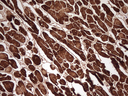 Immunohistochemical staining of paraffin-embedded Human adult heart tissue using anti-MYL4 mouse monoclonal antibody