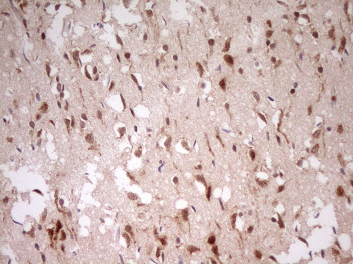 m08496 anti myosin myl4 mouse monoclonal antibody clone id oti1h6 ihc testing 4