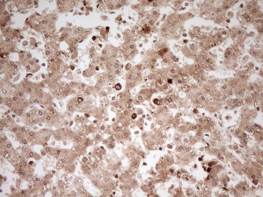 m08496 anti myosin myl4 mouse monoclonal antibody clone id oti1h6 ihc testing 5