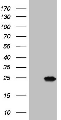 HEK293T cells were transfected with the pCMV6-ENTRY control (Left lane) or pCMV6-ENTRY MYL4 (Right lane) cDNA for 48 hrs and lysed