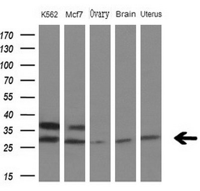 Western blot analysis of extracts (10ug) from 3 different cell lines and 2 human tissue by using anti-MYL4 monoclonal antibody at 1:200 dilution