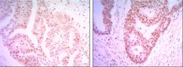 Immunohistochemistry validation of THAP11 using Anti-THAP11 Monoclonal Antibody (M08519)
