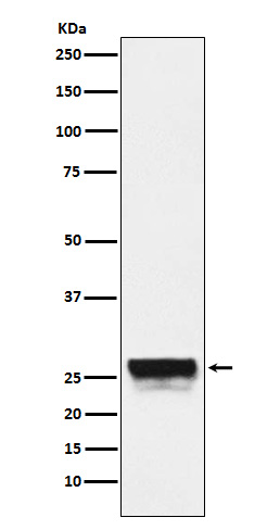 Western blot analysis of CTRL expression in Mouse pancreas lysate