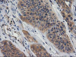 m08549 anti gba3 mouse monoclonal antibody clone id oti1f1 ihc testing 11