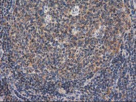 m08549 anti gba3 mouse monoclonal antibody clone id oti1f1 ihc testing 12