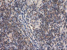 m08549 anti gba3 mouse monoclonal antibody clone id oti1f1 ihc testing 13