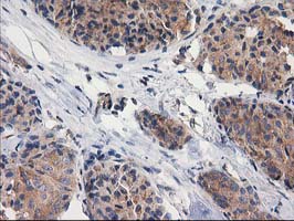 m08549 anti gba3 mouse monoclonal antibody clone id oti1f1 ihc testing 14