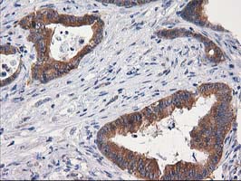 m08549 anti gba3 mouse monoclonal antibody clone id oti1f1 ihc testing 15