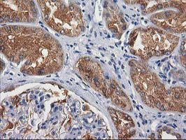 m08549 anti gba3 mouse monoclonal antibody clone id oti1f1 ihc testing 16