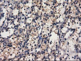 m08549 anti gba3 mouse monoclonal antibody clone id oti1f1 ihc testing 17