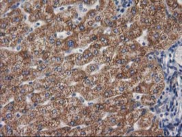 m08549 anti gba3 mouse monoclonal antibody clone id oti1f1 ihc testing 18