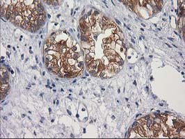 m08549 anti gba3 mouse monoclonal antibody clone id oti1f1 ihc testing 4