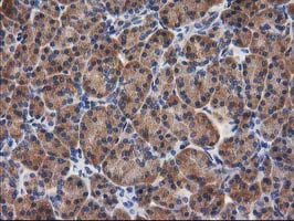 m08549 anti gba3 mouse monoclonal antibody clone id oti1f1 ihc testing 5