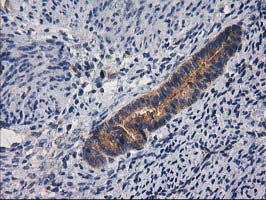 m08549 anti gba3 mouse monoclonal antibody clone id oti1f1 ihc testing 7