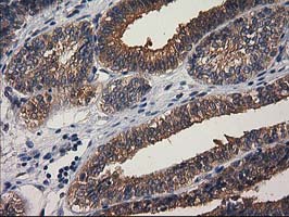 m08549 anti gba3 mouse monoclonal antibody clone id oti1f1 ihc testing 8