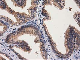 m08549 anti gba3 mouse monoclonal antibody clone id oti1f1 ihc testing 9