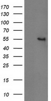 HEK293T cells were transfected with the pCMV6-ENTRY control (Left lane) or pCMV6-ENTRY GBA3 (Right lane) cDNA for 48 hrs and lysed