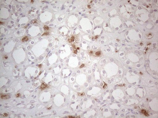 m08566 anti nobox mouse monoclonal antibody clone id oti4c5 ihc testing 5