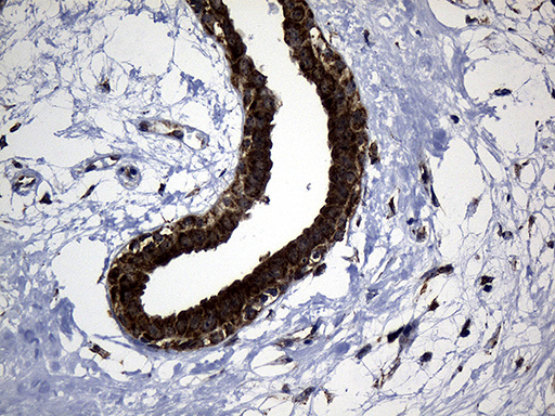 Immunohistochemical staining of paraffin-embedded Human breast tissue within the normal limits using anti-EARS2 mouse monoclonal antibody. (Heat-induced epitope retrieval by 1mM EDTA in 10mM Tris buffer (pH8.5) at 120°C for 3min Immunohistochemical staining of paraffin-embedded Human breast tissue within the normal limits using anti-EARS2 mouse monoclonal antibody. (Heat-induced epitope retrieval by 1mM EDTA in 10mM Tris buffer (pH8.5) at 120°C for 3min