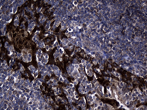 Immunohistochemical staining of paraffin-embedded Human tonsil within the normal limits using anti-EARS2 mouse monoclonal antibody. (Heat-induced epitope retrieval by 1mM EDTA in 10mM Tris buffer (pH8.5) at 120°C for 3min Immunohistochemical staining of paraffin-embedded Human tonsil within the normal limits using anti-EARS2 mouse monoclonal antibody. (Heat-induced epitope retrieval by 1mM EDTA in 10mM Tris buffer (pH8.5) at 120°C for 3min