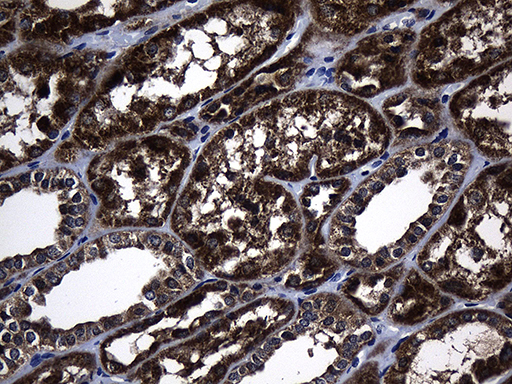Immunohistochemical staining of paraffin-embedded Human Kidney tissue within the normal limits using anti-EARS2 mouse monoclonal antibody. (Heat-induced epitope retrieval by 1mM EDTA in 10mM Tris buffer (pH8.5) at 120°C for 3min Immunohistochemical staining of paraffin-embedded Human Kidney tissue within the normal limits using anti-EARS2 mouse monoclonal antibody. (Heat-induced epitope retrieval by 1mM EDTA in 10mM Tris buffer (pH8.5) at 120°C for 3min
