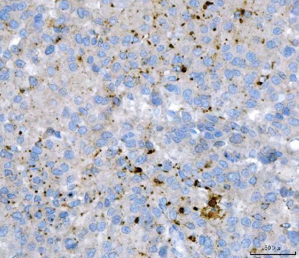  IHC analysis of KLHL12 using anti-KLHL12 antibody (M08568-1)