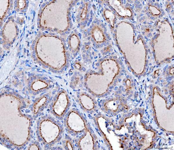  IHC analysis of KLHL12 using anti-KLHL12 antibody (M08568-1)